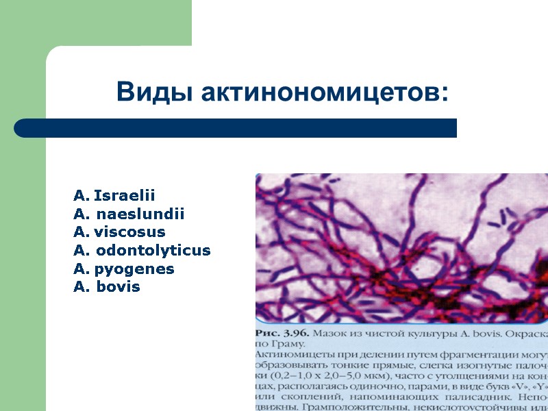 Виды актинономицетов: Israelii A. naeslundii viscosus A. odontolyticus pyogenes A. bovis